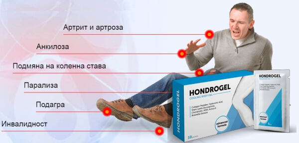 hondrogel ефекти, болки в стави, мъж