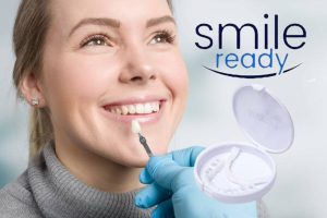 Smile Ready Мнения – Уникални Подвижни Фасети за Приказно Бяла Усмивка